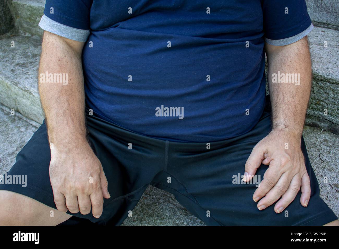 fat, obese man's belly close up with diabetes and in ill health outdoors sitting Stock Photo