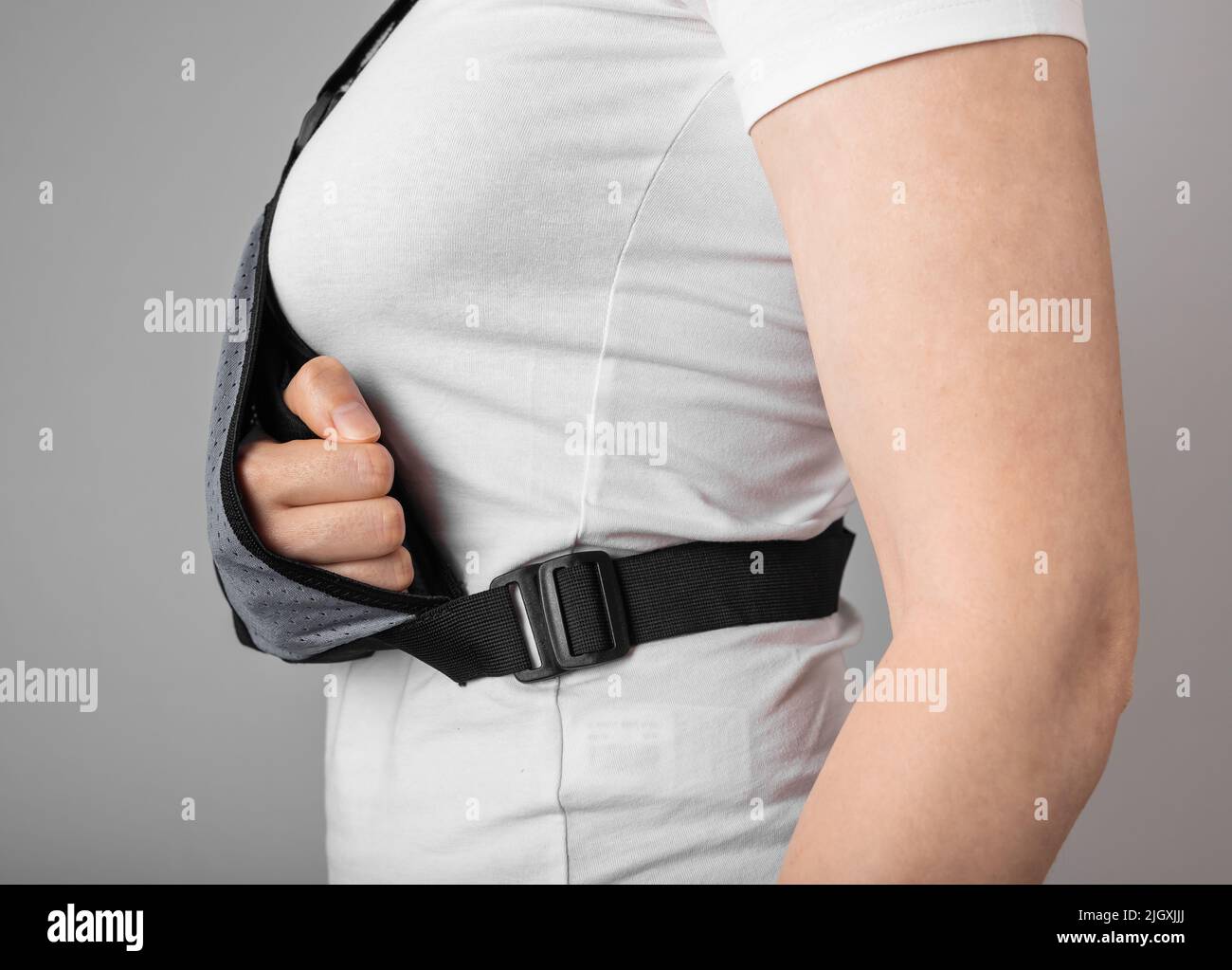 Bone fracture healing hires stock photography and images Alamy