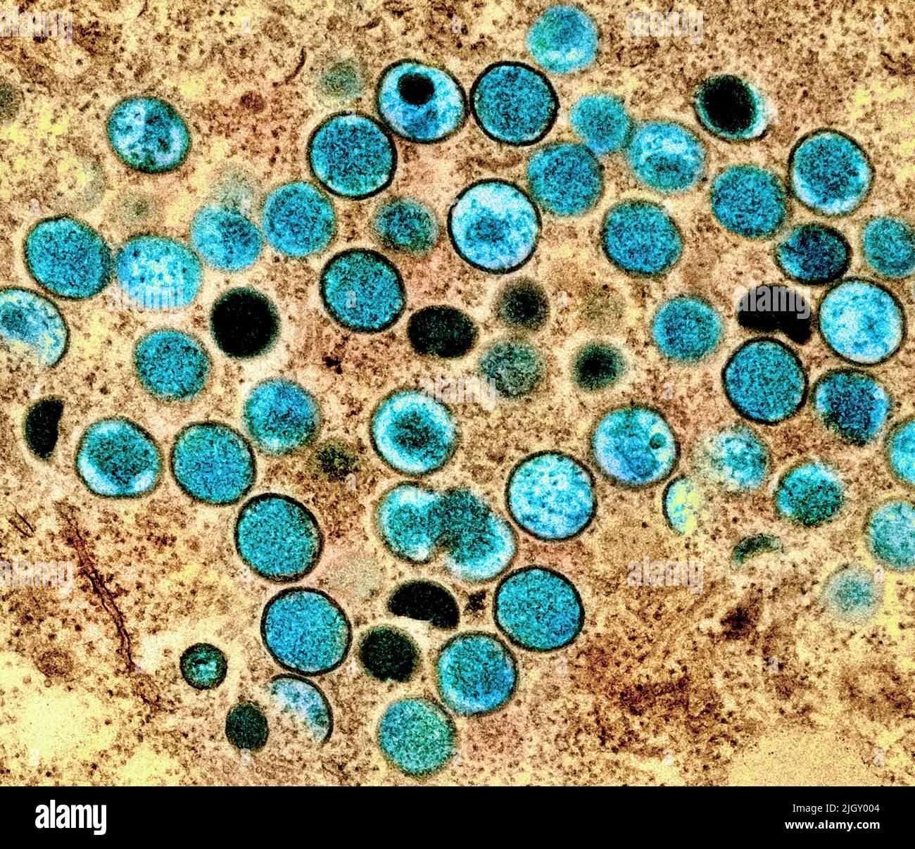 Monkeypox. Colorized transmission electron micrograph of mature extracellular Nipah Virus particles (red) near the periphery of an infected VERO cell (blue and green). Image captured at the NIAID Integrated Research Facility in Fort Detrick, Maryland. Credit NIAID Monkeypox is an infectious viral disease that can occur in humans and some other animals.Symptoms include fever, swollen lymph nodes, and a rash that forms blisters and then crusts over. The time from exposure to onset of symptoms ranges from 5 to 21 days. The duration of symptoms is typically 2 to 4 weeks. Stock Photo