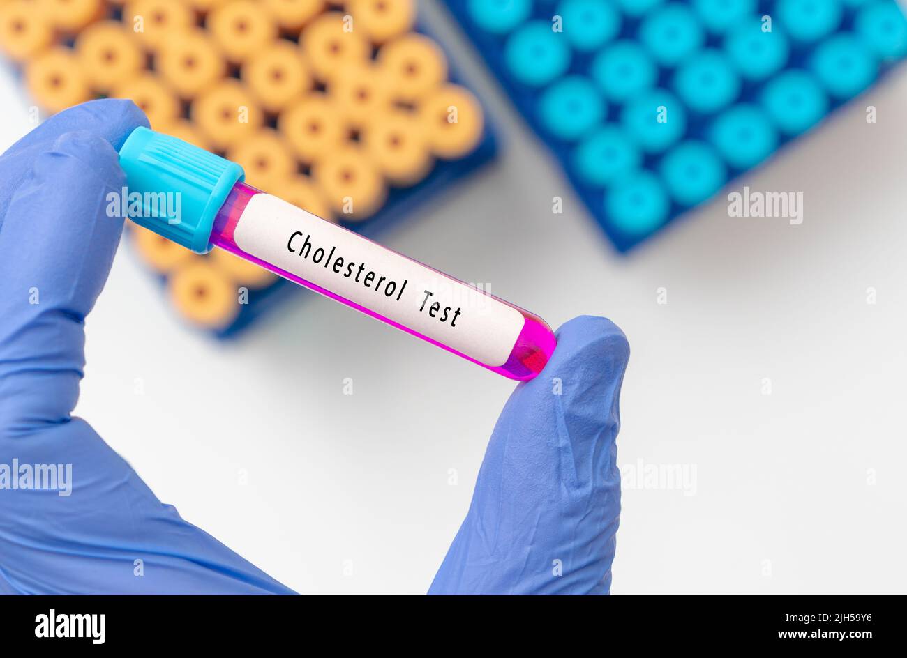 Cholesterol test result with blood sample in test tube on doctor hand