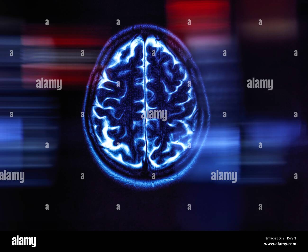 Alzheimer's and dementia research, conceptual image Stock Photo
