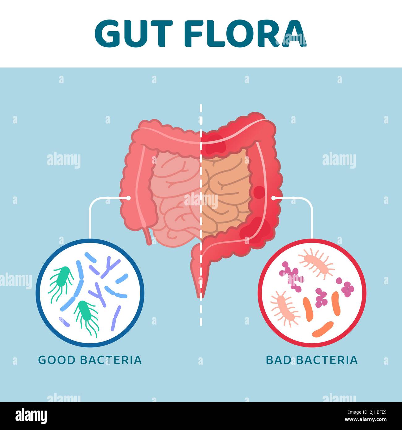 Good and bad gut bacteria: comparison between healthy intestine and unhealthy intestine Stock Vector