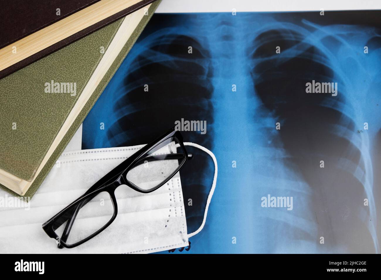 x-ray of the lungs, X-ray film of the patient. medical concept. Coronavirus infection COVID-19 . Stock Photo
