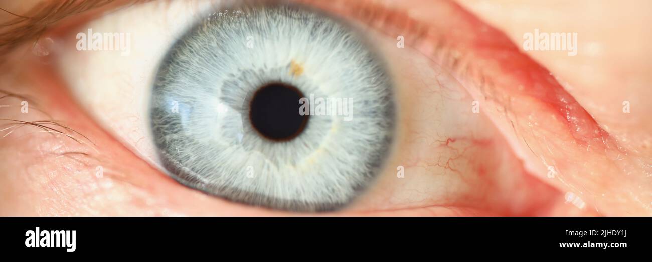 Light blue human eye colour, extreme macro shot of persons vision Stock Photo