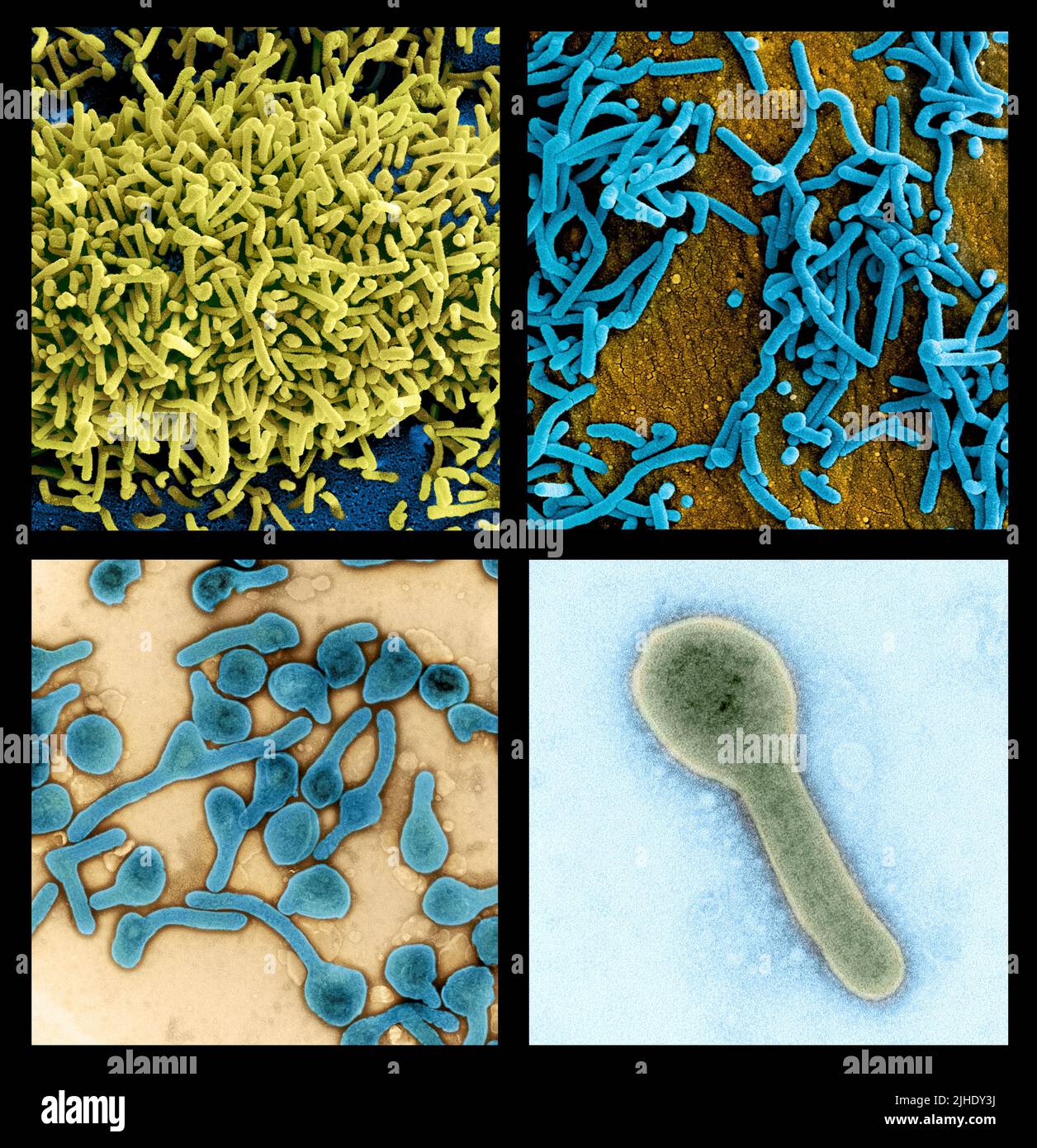 Ghana has confirmed its first two cases of the deadly Marburg virus, a highly infectious disease in the same family as the virus that causes Ebola. Both patients died in hospital in the Ashanti region in the south of the country. 18 July 2022  A unique composite of 4 scanning electron micrograph images of Marburg virus particles harvested from infected VERO E6 cells. High resolution (c.40x40cm at 300dpi; 70MB) files that can be edited to single images as desired.  An optimised and enhanced unique composite version of 4 scanning electron micrograph images, Credit: NIAID / Alamy LIve News Stock Photo