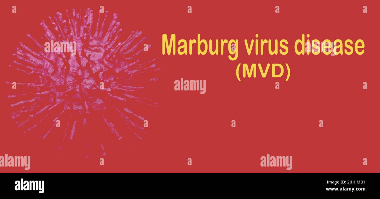 Marburg virus disease. Marburg virus disease (MVD) or Marburg haemorrhagic fever outbreak concept. Virus causes severe viral haemorrhagic fever Stock Photo