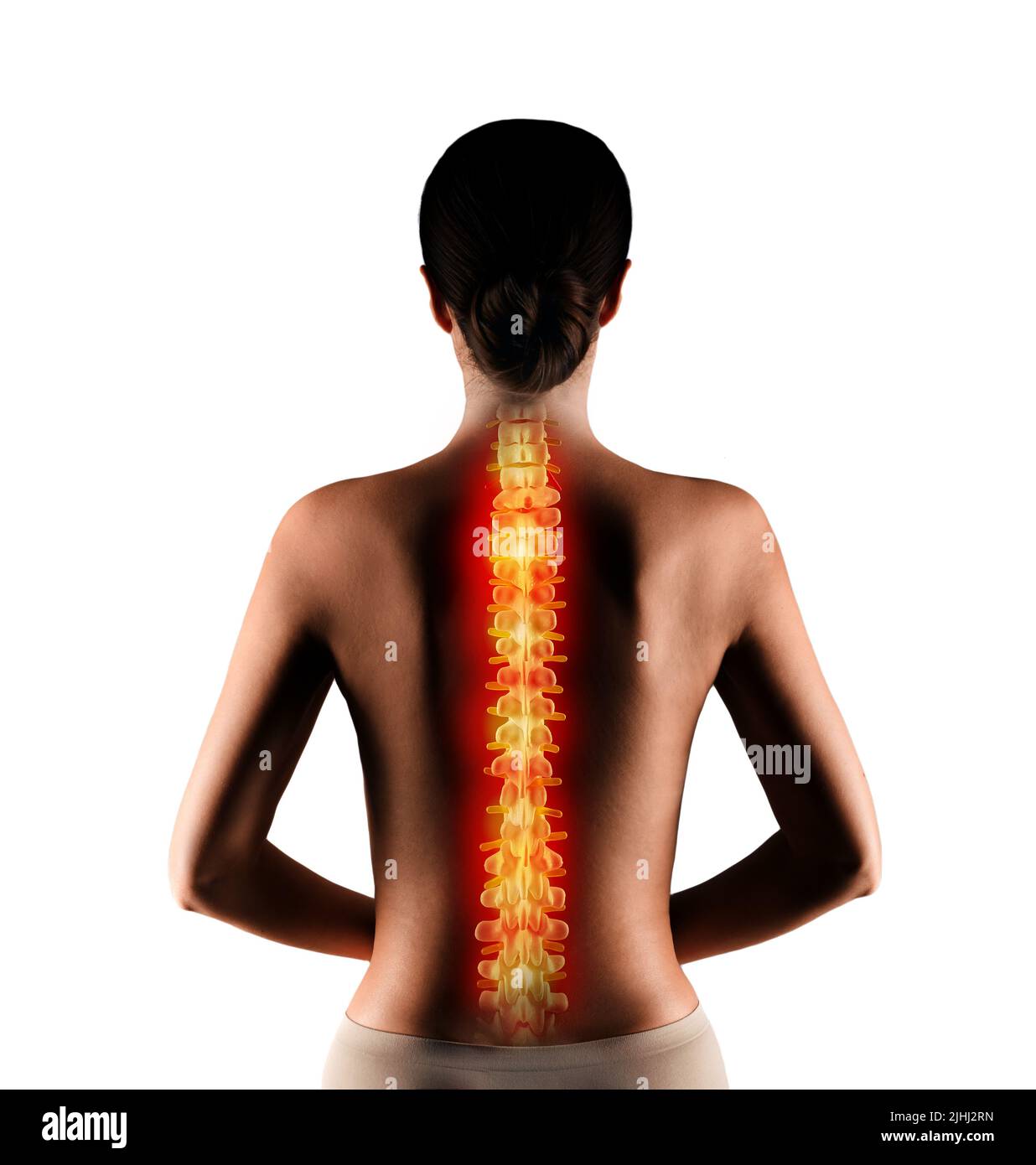 Woman with back pain. Illuminated red spine of woman illustrates backache and back trouble Stock Photo
