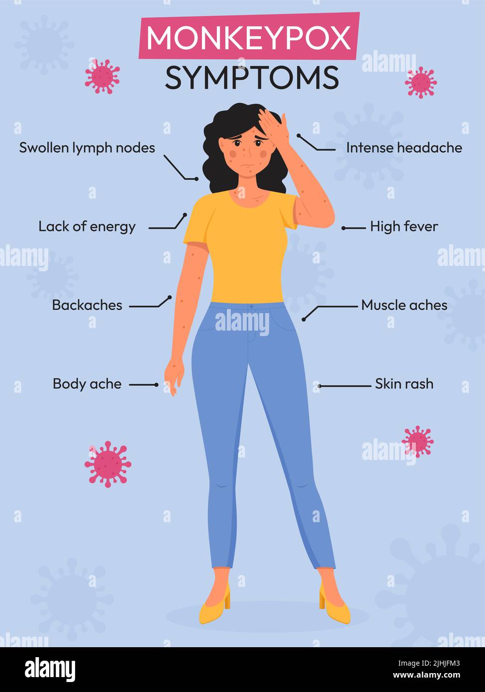 Monkeypox outbreak. Monkeypox virus symptoms infographic. Flat vector ...