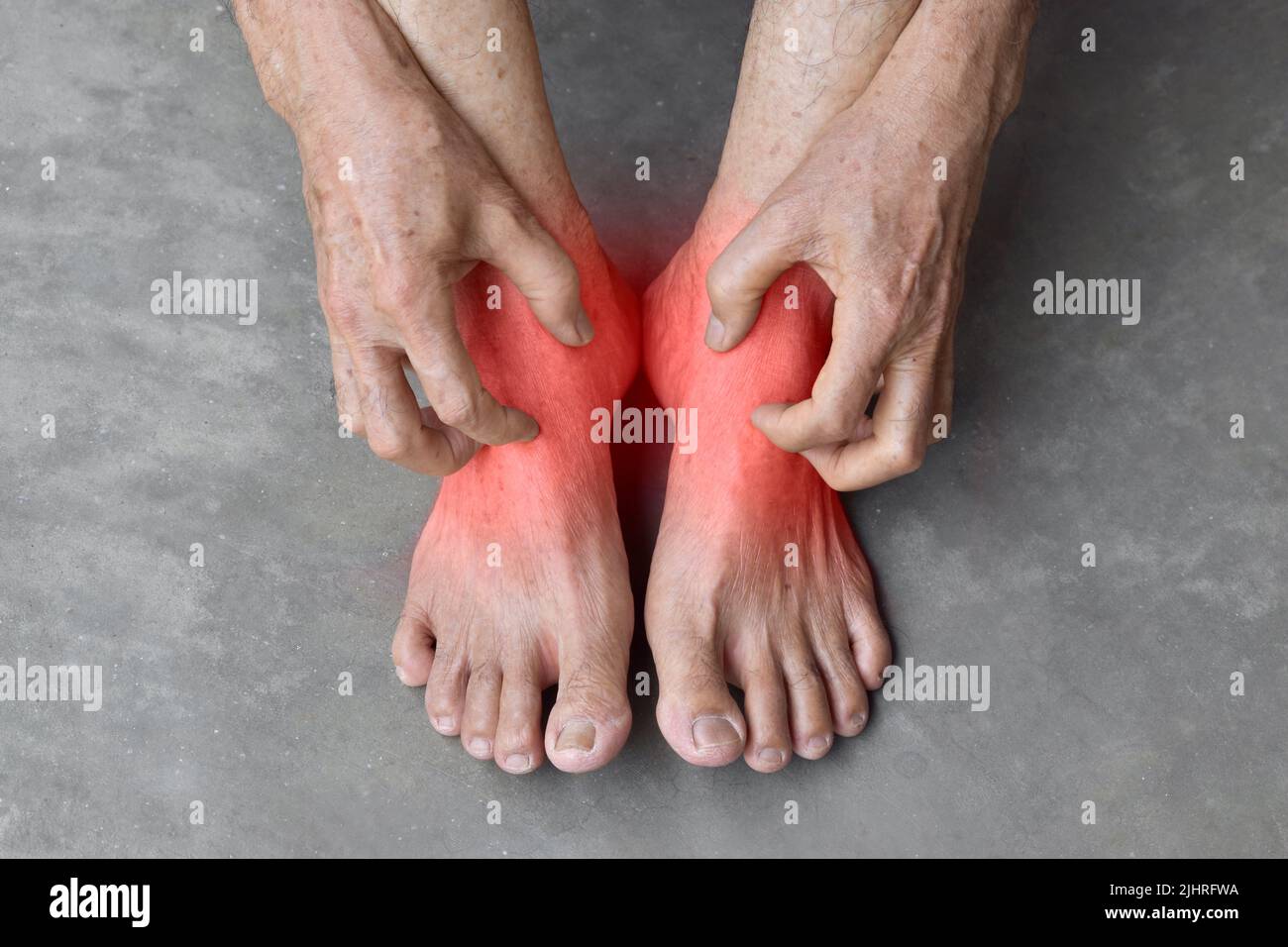 Asian elder man scratching his foot. Concept of itchy skin diseases such as scabies, fungal infection, eczema, psoriasis, allergy, etc. Stock Photo