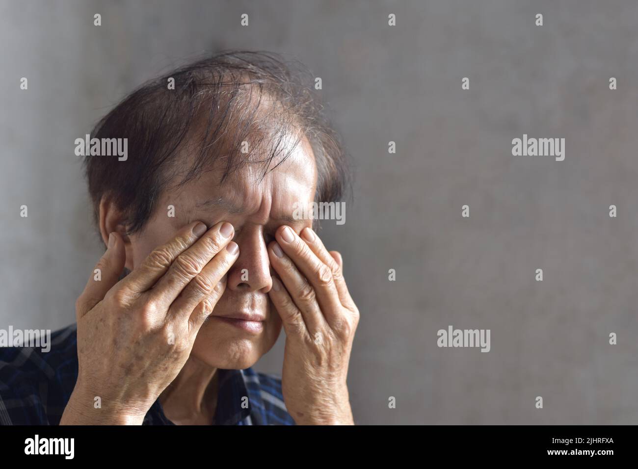 Asian elder man rubbing his eye. Concept of eye pain, strain or itchy eyelid. Stock Photo