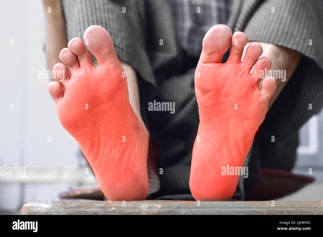 Tingling and burning sensation in feet of Asian old man with diabetes. Foot pain. Sensory neuropathy problems. Foot nerves problems. Plantar fasciitis Stock Photo