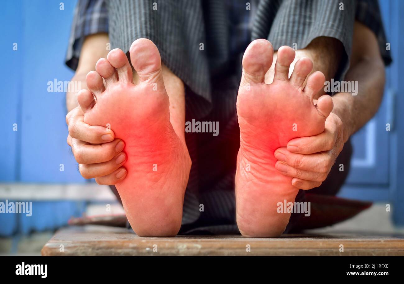Tingling and burning sensation in feet of Asian old man with diabetes. Foot pain. Sensory neuropathy problems. Foot nerves problems. Plantar fasciitis Stock Photo