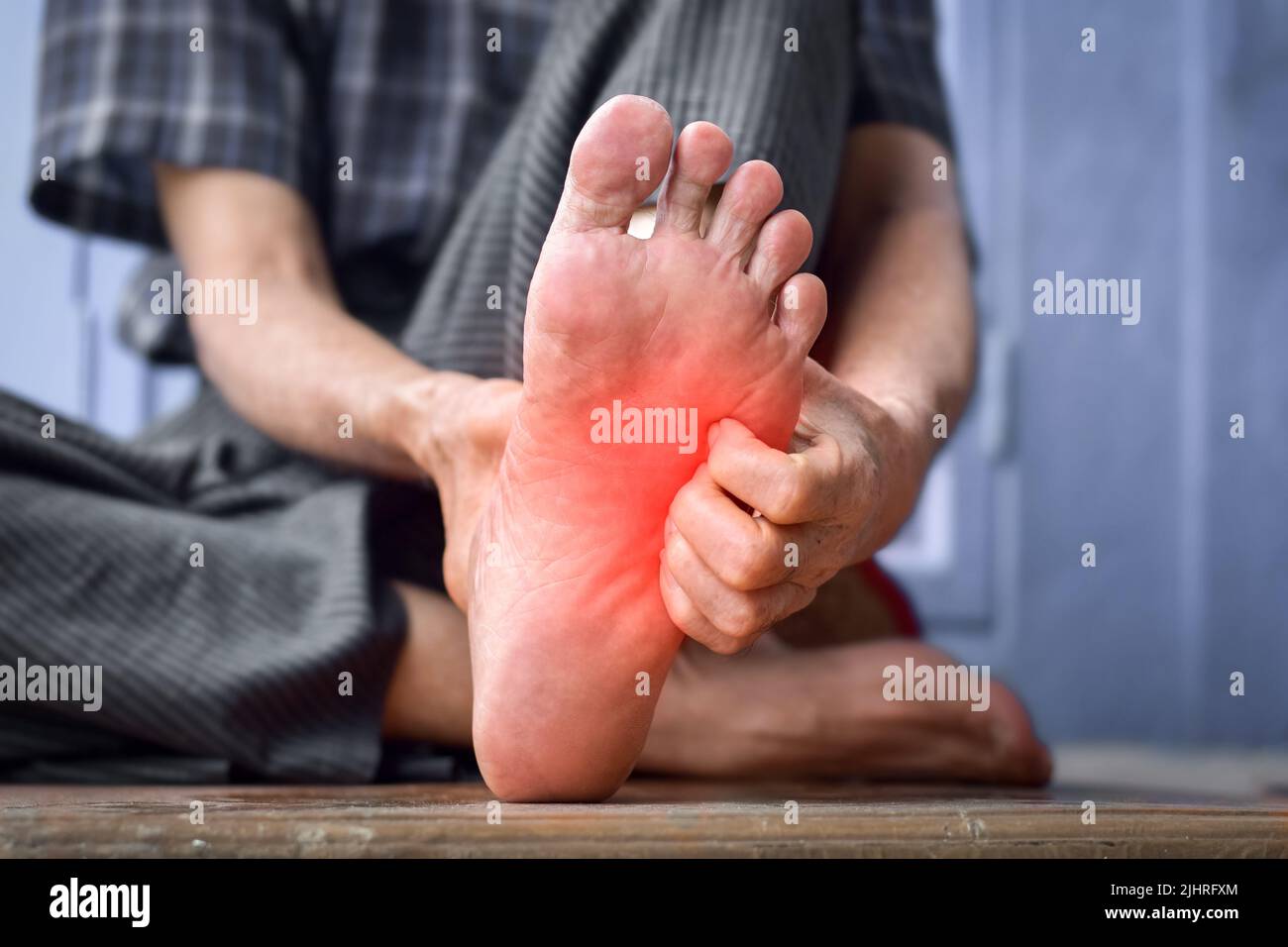 Itchy foot skin of Asian elder man. Concept of skin diseases such as scabies, fungal infection, allergy, etc. Stock Photo