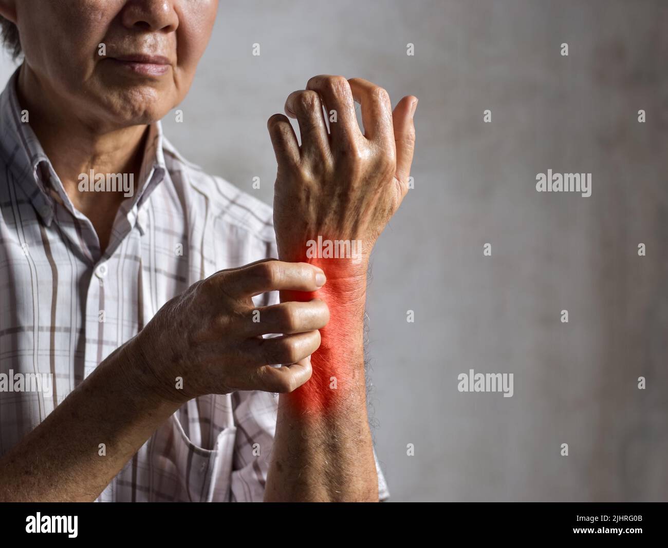 Asian elder man scratching his forearm. Concept of itchy skin diseases such as scabies, fungal infection, eczema, psoriasis, allergy, etc. Stock Photo