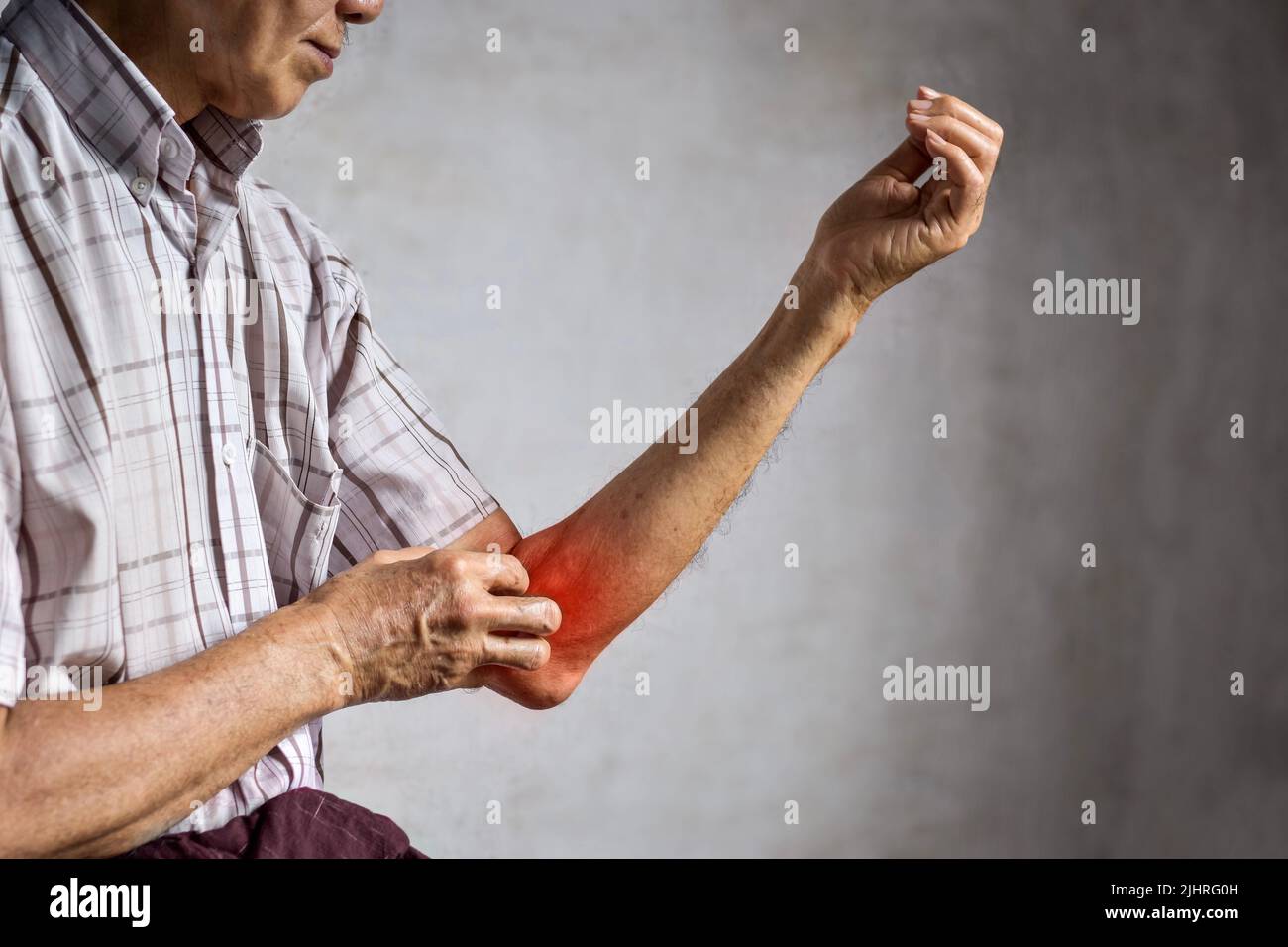 Asian elder man scratching his arm. Concept of itchy skin diseases such as scabies, fungal infection, eczema, psoriasis, allergy, etc. Stock Photo