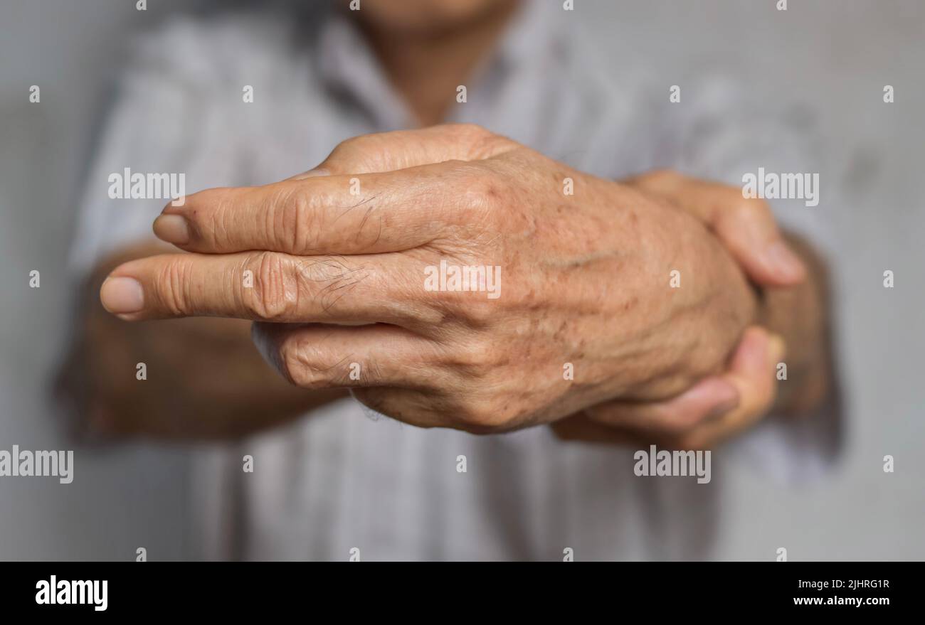 Fingers rigidity, Hand muscles spasm, or Weakness of digits. Closeup view. Stock Photo