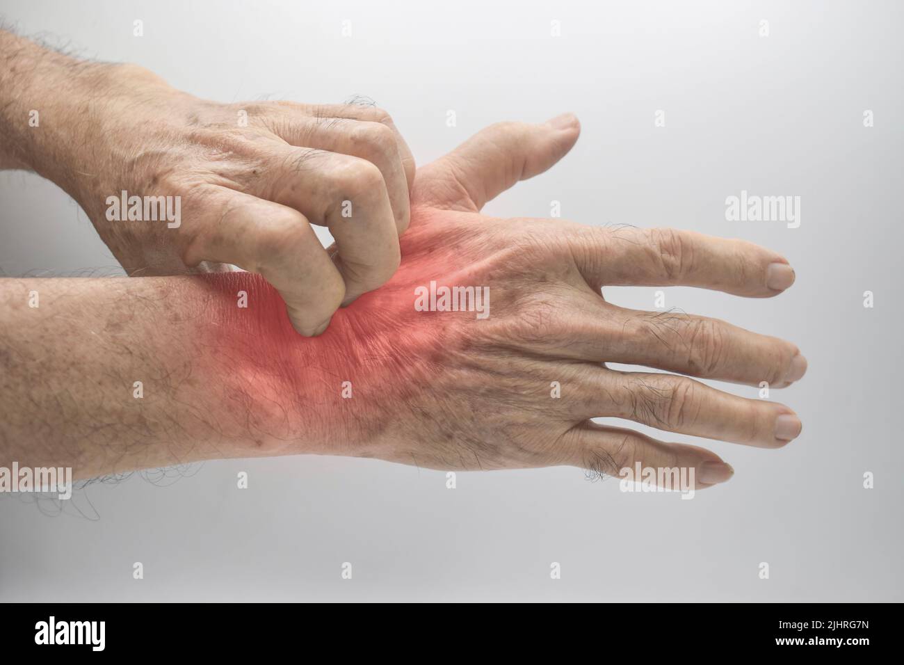 Asian elder man scratching his hand. Concept of itchy skin diseases such as scabies, fungal infection, eczema, psoriasis, allergy, etc. Stock Photo