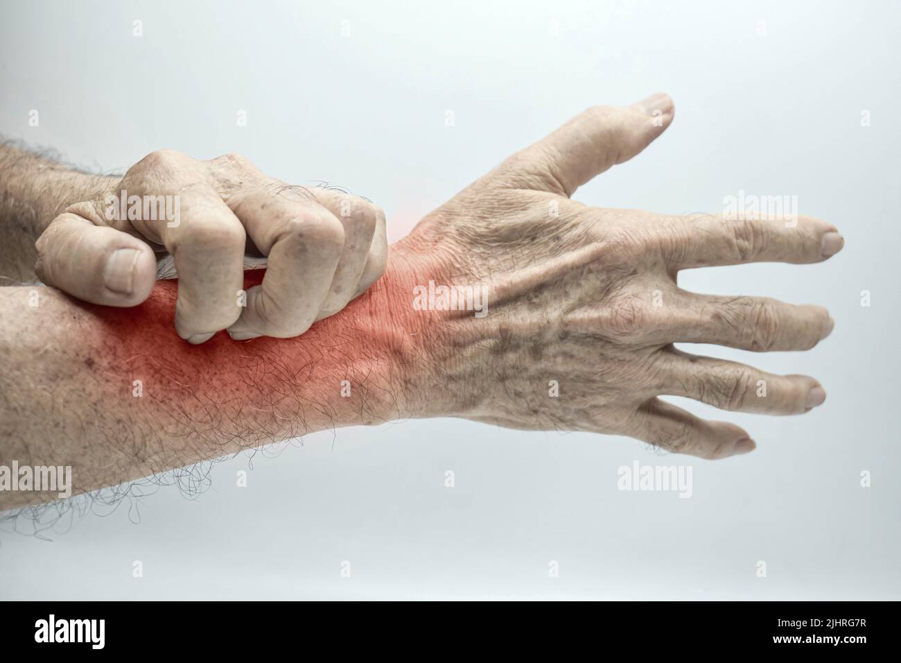 Asian elder man scratching his forearm. Concept of itchy skin diseases such as scabies, fungal infection, eczema, psoriasis, allergy, etc. Stock Photo