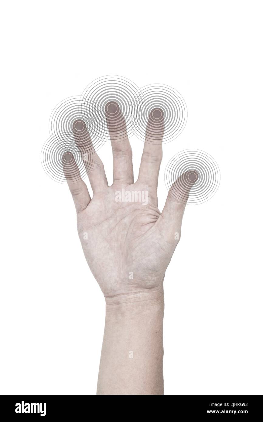 Tingling and numbness in fingertips of Asian young man with diabetes