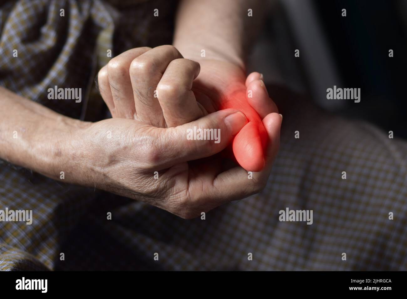 Inflammation of Asian old man thumb. Concept of painful digit, cellulitis or finger problems. Stock Photo