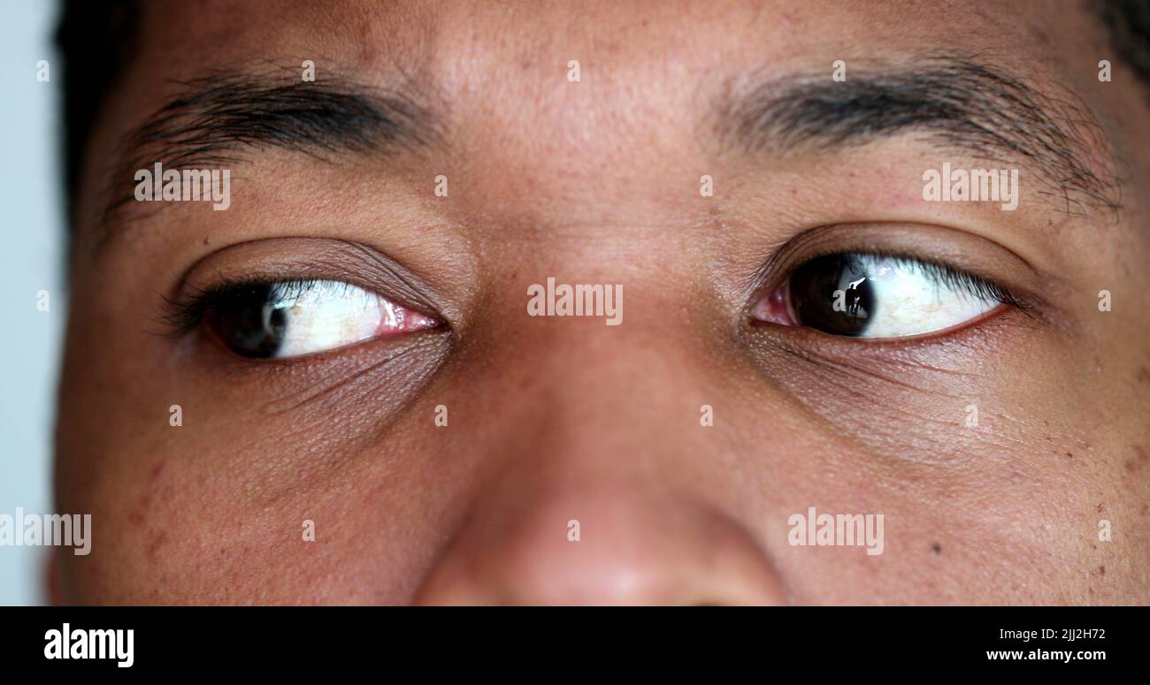 African american macro close-up eyes in SHOCK surprised reaction Stock  Photo - Alamy