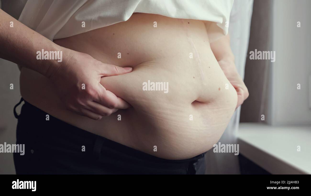 Aged woman compresses skin on abdomen checking fat excess Stock Photo