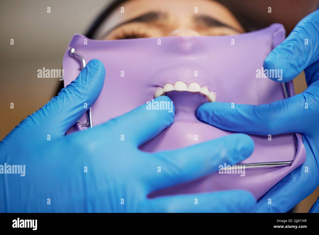 Improving lives one smile at a time. a young woman having dental work done on her teeth Stock