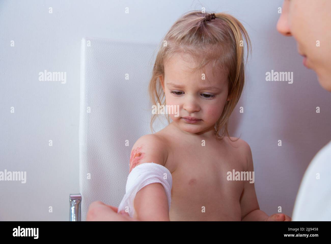 Child burn injury, burns treatment and healing, pediatrician is