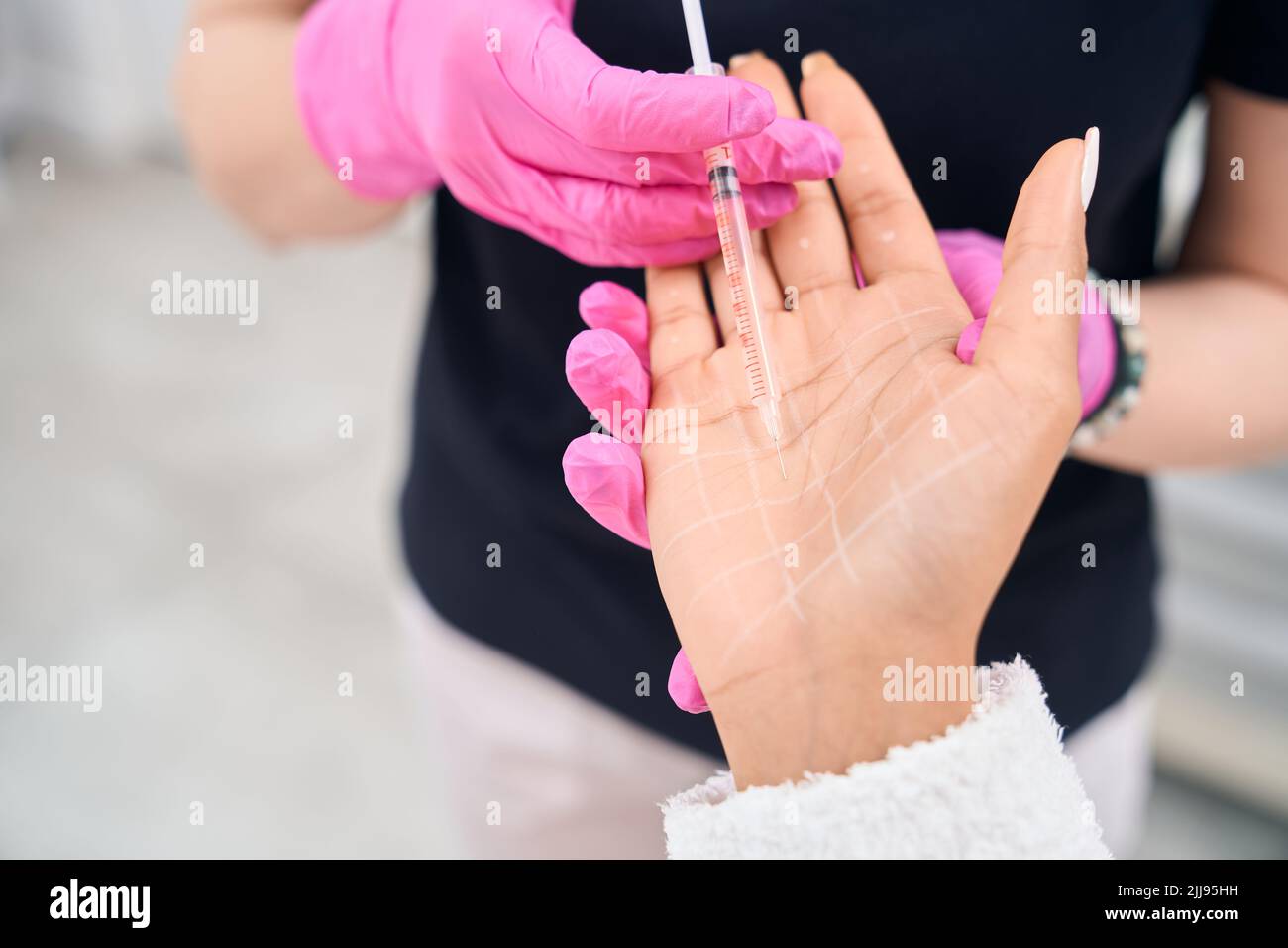 Woman receiving botulinum toxin injections for excessive palm sweating
