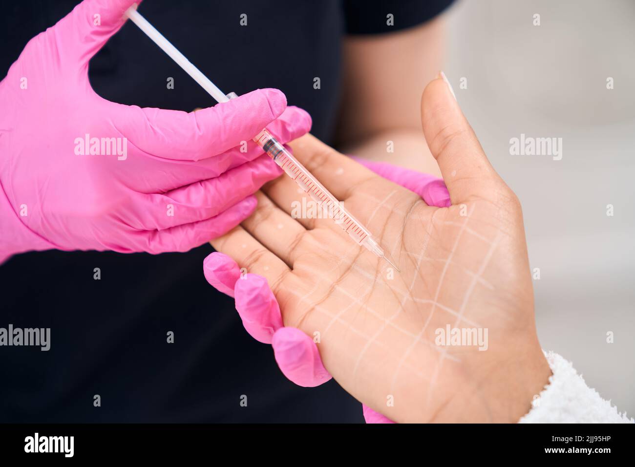 Woman on the procedure for correcting sweating of the palms Stock Photo