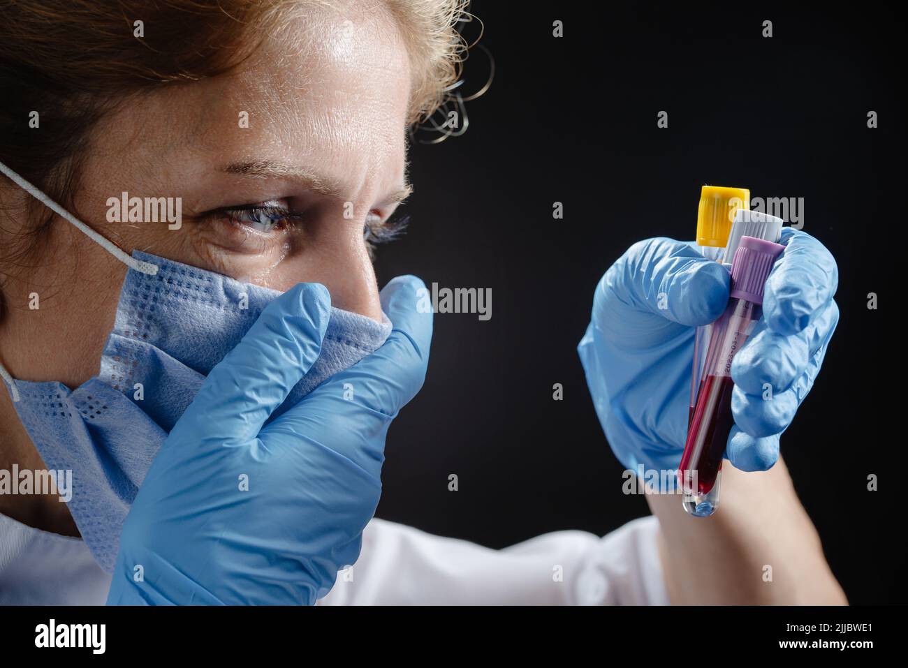 A woman doctor in a protective medical mask looks at the blood tubes and cries. The doctor cries when he sees the bad tests. The doctor is upset and Stock Photo