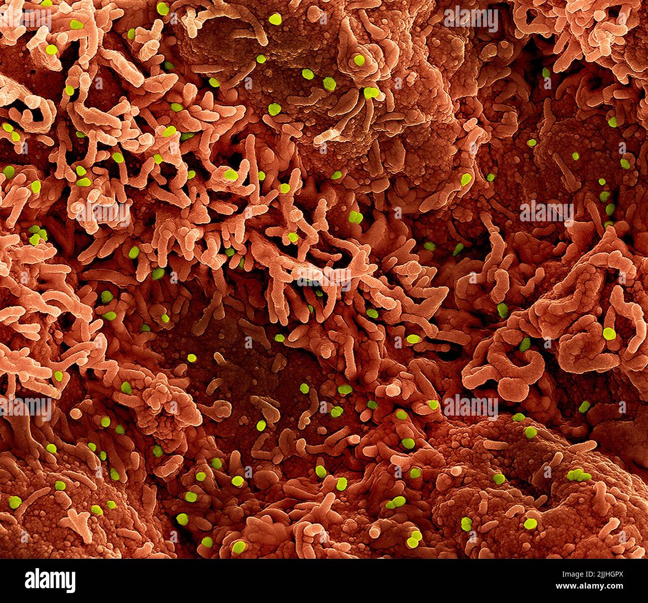 Fort Detrick, United States. 26th July, 2022. A colorized scanning electron micrograph of monkeypox virus (lime) on the surface of infected VERO E6 cells (orange) captured at the NIAID Integrated Research Facility released July 26, 2022, in Fort Detrick, Maryland. Credit: NIAID/NIAID/Alamy Live News Stock Photo