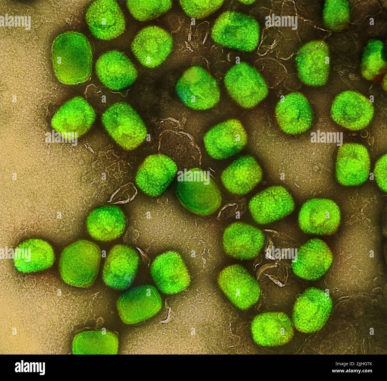 Fort Detrick, United States. 26th July, 2022. A colorized transmission electron micrograph of monkeypox virus particles (green) cultivated and purified from cell culture captured at the NIAID Integrated Research Facility released July 26, 2022, in Fort Detrick, Maryland. Credit: NIAID/NIAID/Alamy Live News Stock Photo
