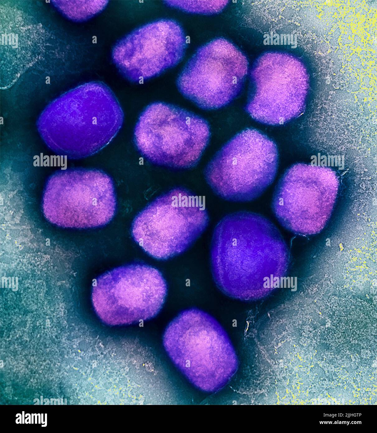 Fort Detrick, United States. 26th July, 2022. A colorized transmission electron micrograph of monkeypox virus particles (purple) cultivated and purified from cell culture captured at the NIAID Integrated Research Facility released July 26, 2022, in Fort Detrick, Maryland. Credit: NIAID/NIAID/Alamy Live News Stock Photo