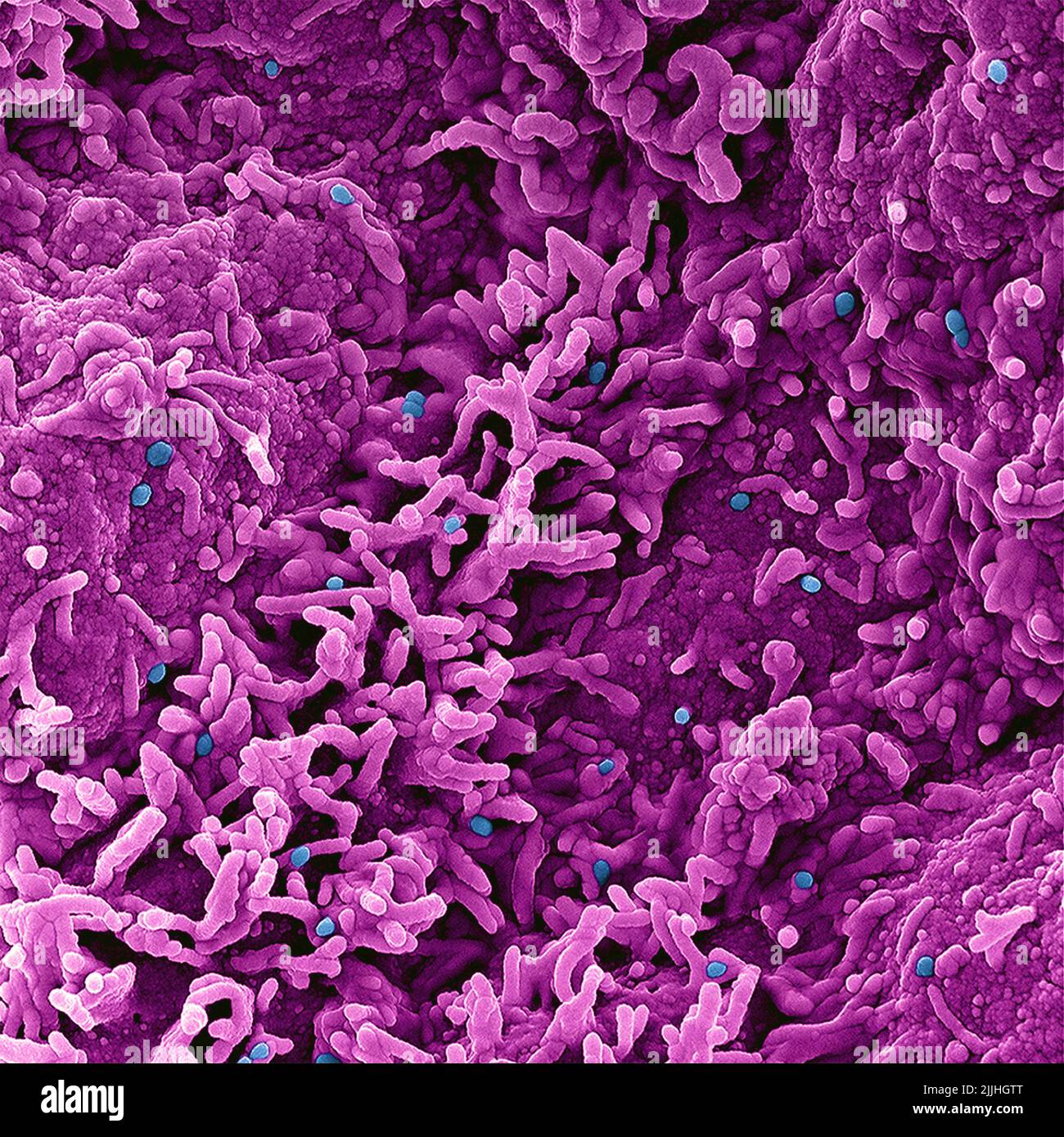 Fort Detrick, United States. 26th July, 2022. A colorized scanning electron micrograph of monkeypox virus (blue) on the surface of infected VERO E6 cells (pink) captured at the NIAID Integrated Research Facility released July 26, 2022, in Fort Detrick, Maryland. Credit: NIAID/NIAID/Alamy Live News Stock Photo