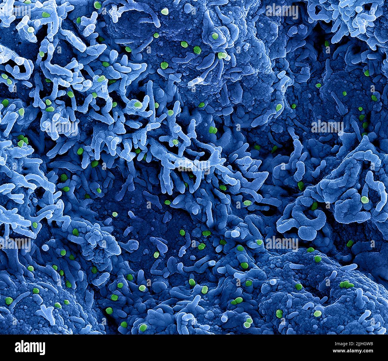 Fort Detrick, United States. 26th July, 2022. A colorized scanning electron micrograph of monkeypox virus (green) on the surface of infected VERO E6 cells (blue) captured at the NIAID Integrated Research Facility released July 26, 2022, in Fort Detrick, Maryland. Credit: NIAID/NIAID/Alamy Live News Stock Photo