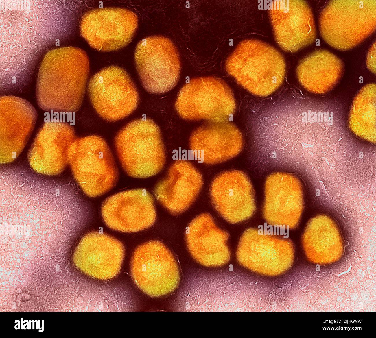 Fort Detrick, United States. 26th July, 2022. A colorized transmission electron micrograph of monkeypox virus particles (gold) cultivated and purified from cell culture captured at the NIAID Integrated Research Facility released July 26, 2022, in Fort Detrick, Maryland. Credit: NIAID/NIAID/Alamy Live News Stock Photo