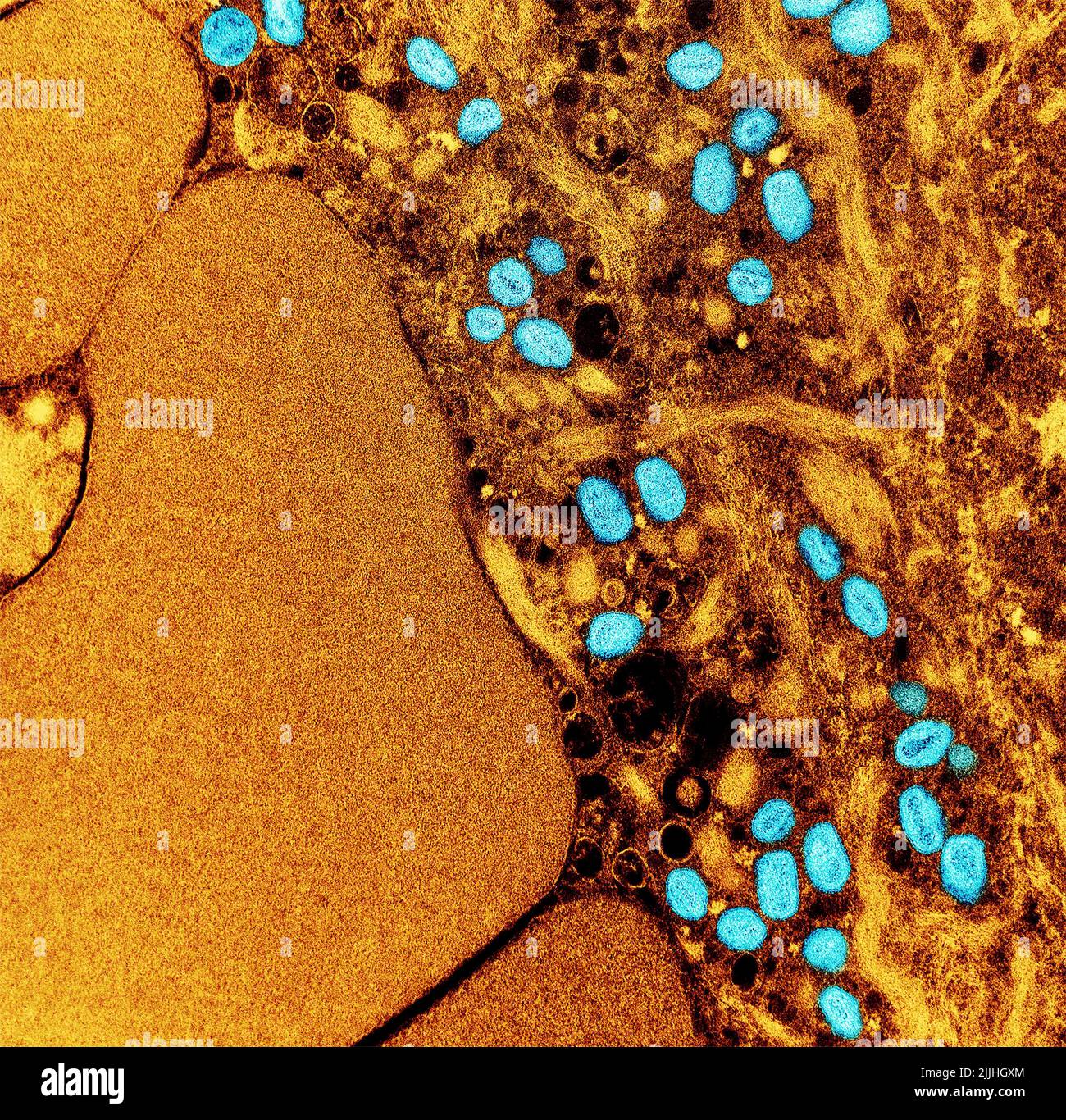 Fort Detrick, United States. 26th July, 2022. A colorized transmission electron micrograph of monkeypox virus particles (teal) found within an infected cell (brown) cultured in the laboratory and captured at the NIAID Integrated Research Facility released July 26, 2022, in Fort Detrick, Maryland. Credit: NIAID/NIAID/Alamy Live News Stock Photo