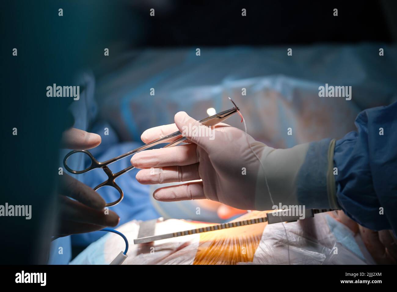 Closeup Of Professional Doctor Hands Operating A Patient During Open 