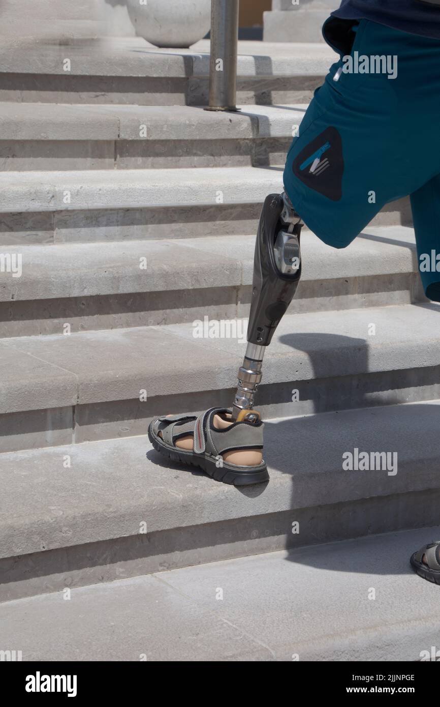 man with left leg prosthesis walks on a staircase wearing sandals and sporty shorts Stock Photo