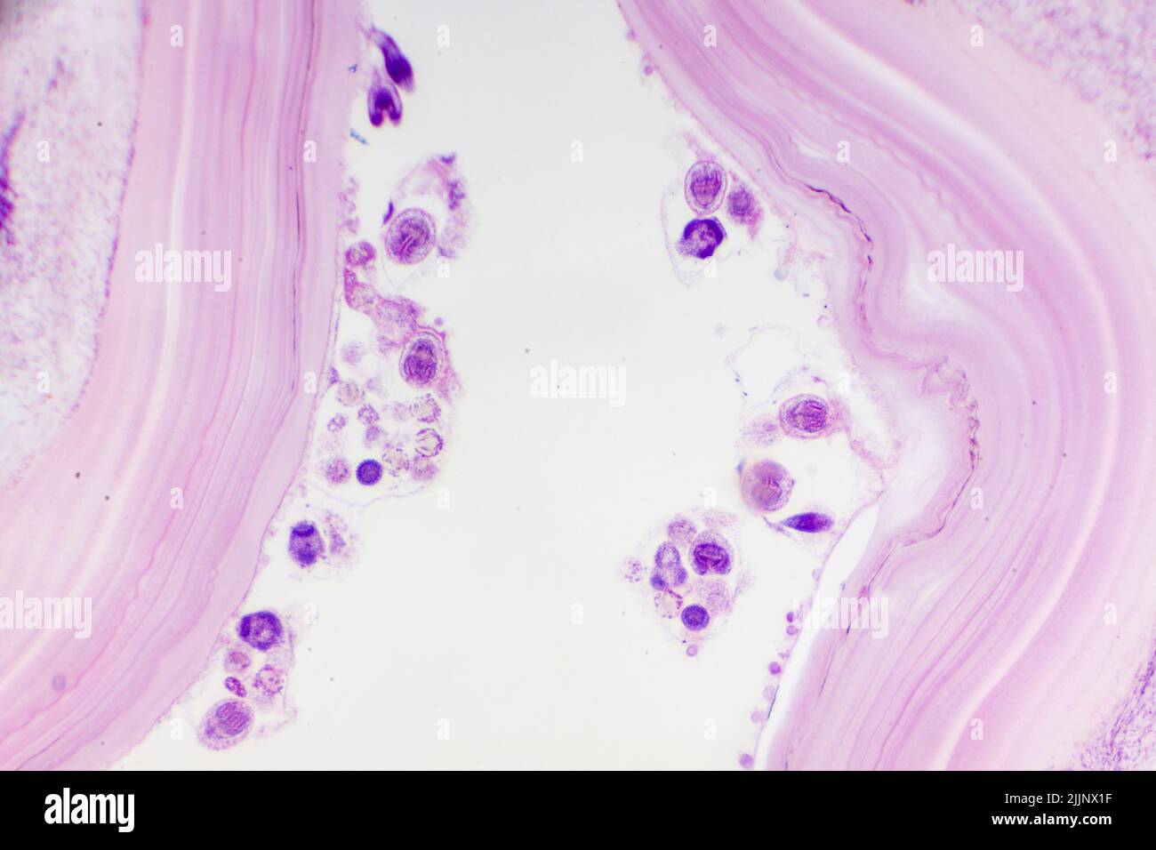 Hydatid cyst caused by tapeworm parasite Echinococcus granulosus, light photomicrograph, X40 Stock Photo
