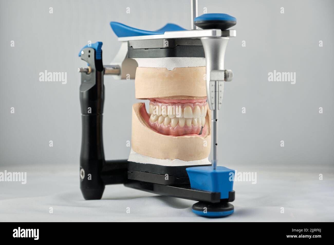 Dental photo of the articulator and two dental prostheses in the