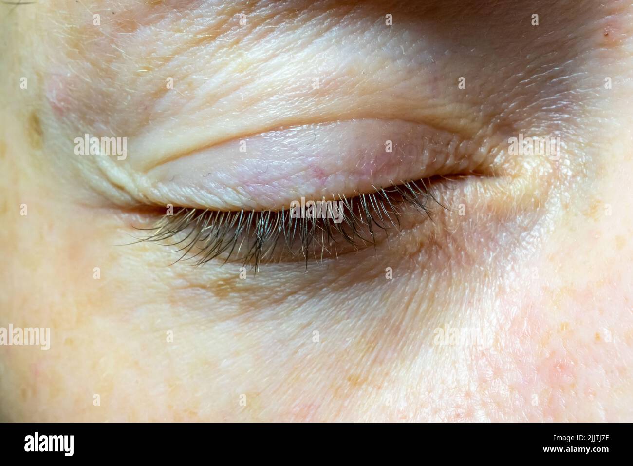 Woman's closed eye close-up. Problematic skin near the eye Stock Photo