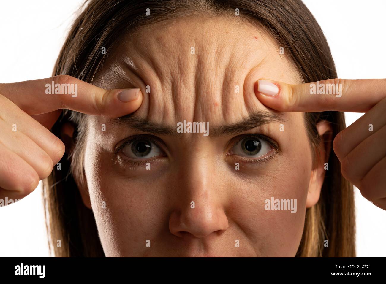 young woman showing her forehead wrinkles with her fingers on a white