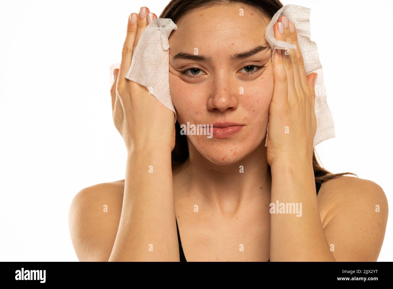 Young woman cleaning her face with wet wipes on white background Stock