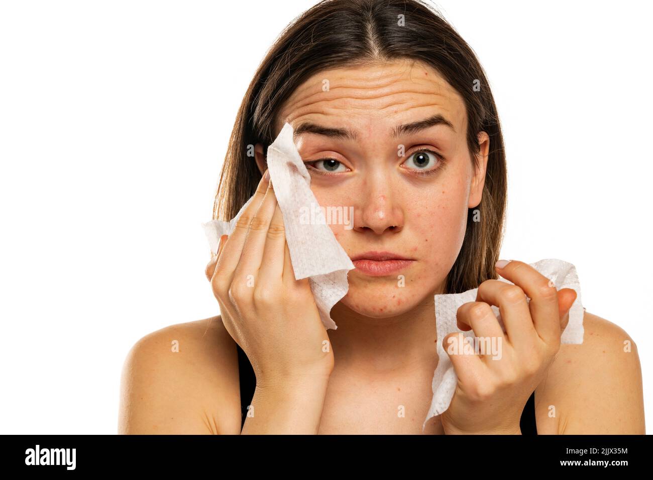 Young woman cleaning her face with wet wipe on white background Stock