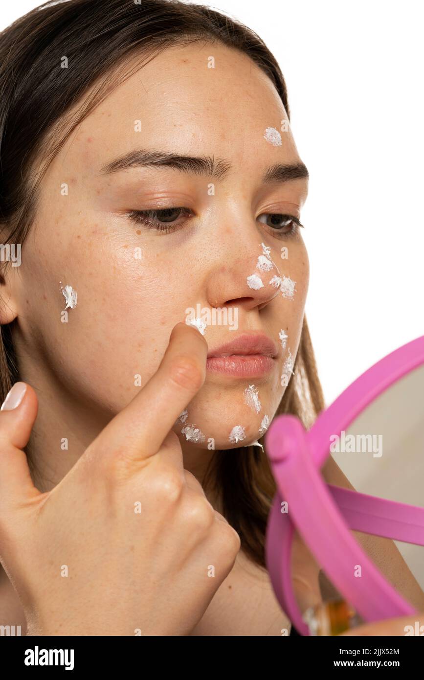 Woman applying acne cream on her face for solving acne inflammation on
