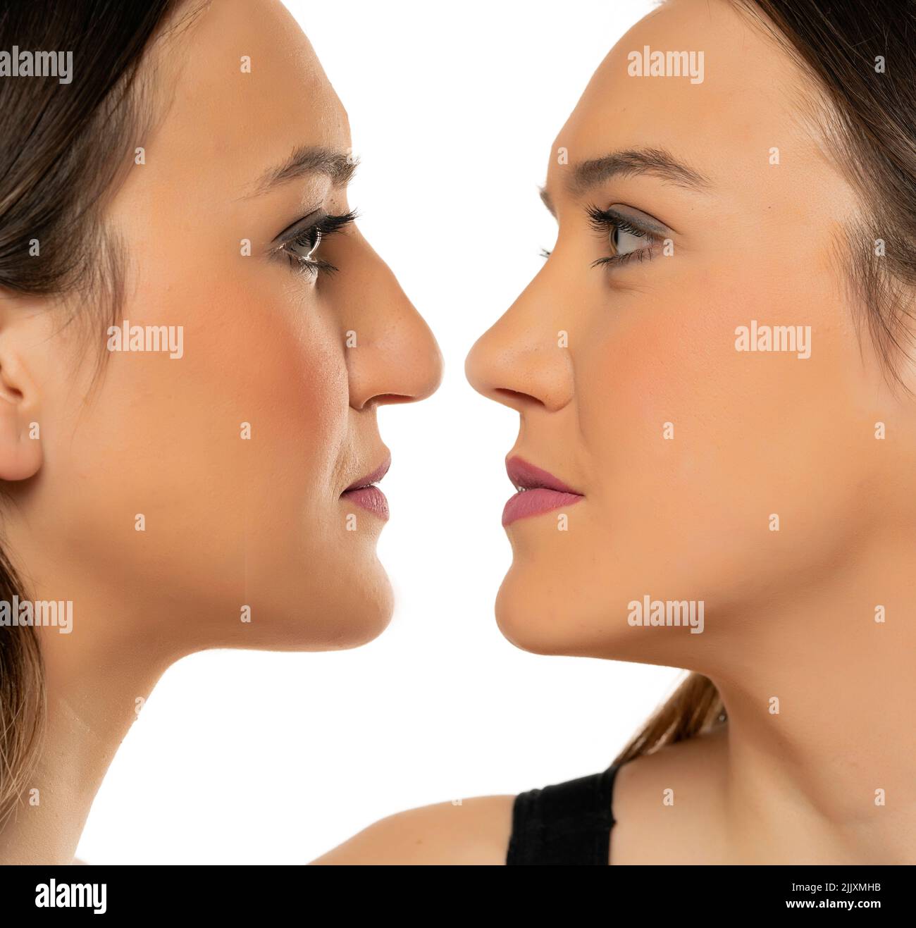 comparative portrait of female face, before and after plastic surgery of the nose on a white background Stock Photo