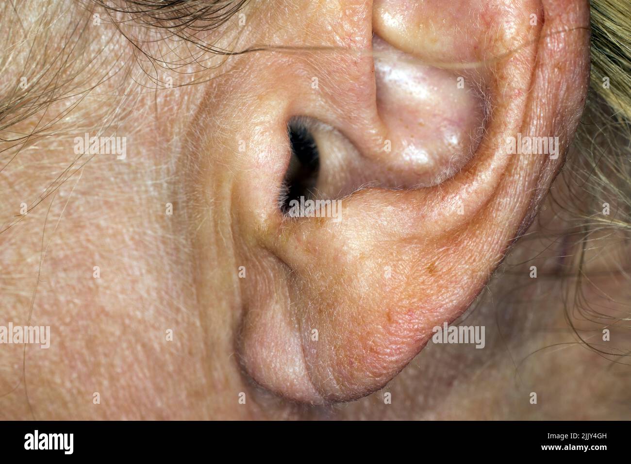 Ear of an elder woman Stock Photo
