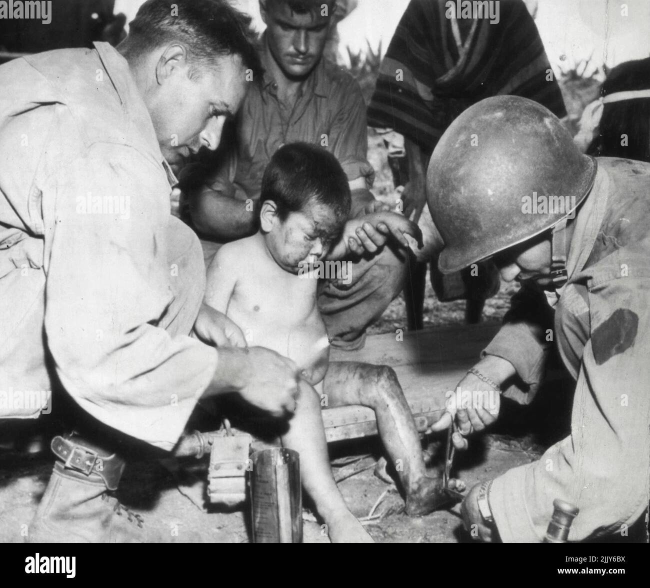 Medical Attention For Japanese Child: Medical ***** of Tenth Army work on the toe of a small Japanese boy who was injured ***** during the American invasion of the Japanese Ryukyu island of Okinawa. American force invaded the island April 1. ***** : Japanese boy on Ryukyu Island has an injured ***** treated by kindly US Army Medical Corps men. The boy had been hurt during the American invasion. April 24, 1945. (Photo by AP Wirephoto). Stock Photo